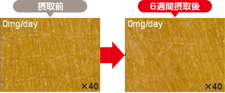 34歳女性（腓腹上部）：接種前と6習慣摂取後の肌の状態
