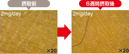 36歳男性（腓腹上部）：接種前と6習慣摂取後の肌の状態