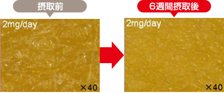 30歳女性（前腕内側部）：接種前と6習慣摂取後の肌の状態