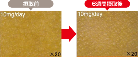 25歳女性（前腕内側部）：接種前と6習慣摂取後の肌の状態