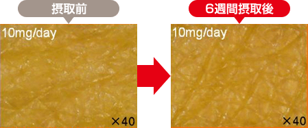 62歳男性（前腕内側部）：接種前と6習慣摂取後の肌の状態