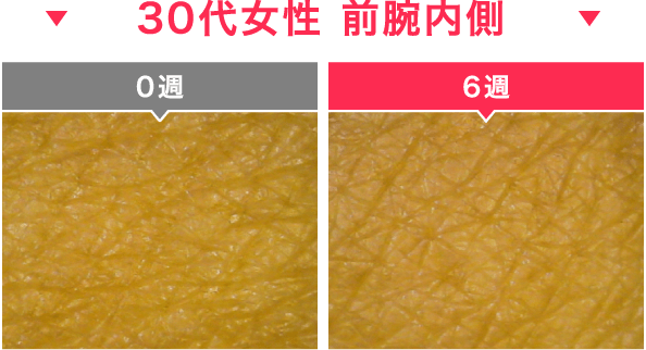 30代女性 前腕内側