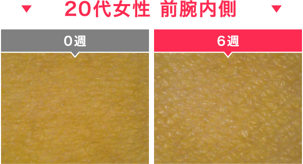 20代女性 前腕内側